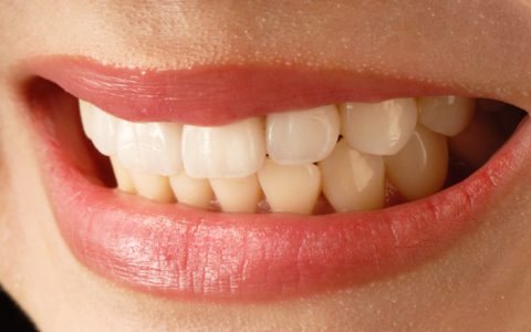 子どもがすきっ歯に…矯正は必要？