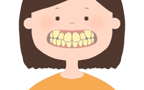 気になる歯の黄ばみ・・・