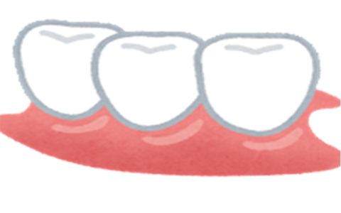 歯を失ってしまったら？