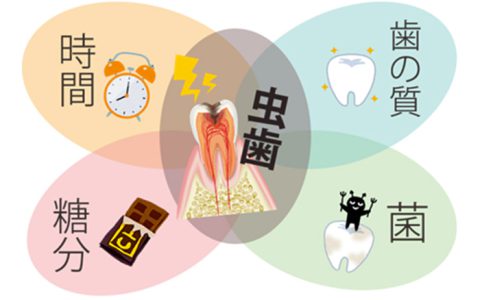 歯磨きしてるのになんで虫歯に？