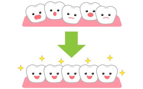 歯列矯正に年齢制限はあるのか