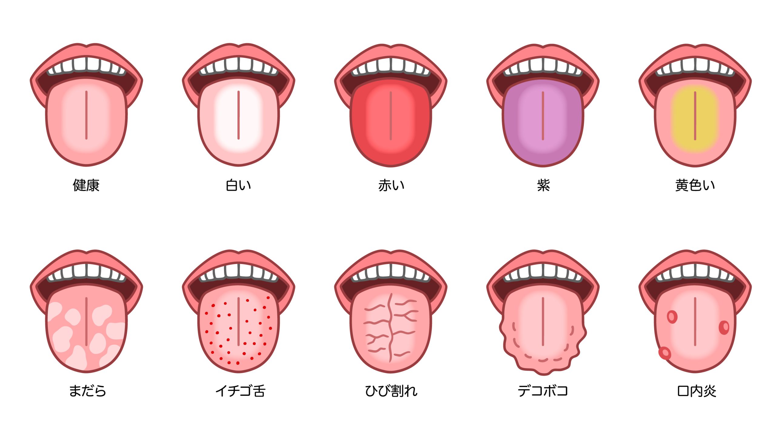 体調は舌の色にあらわれる！？ | 医療法人社団徳治会 徳治会歯科医院八代 [旧 松下歯科医院] | 熊本県八代市