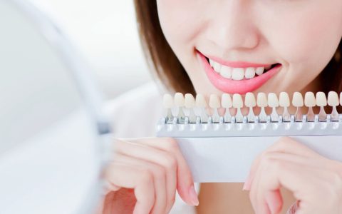 市販と歯科のホワイトニングの違いとは？